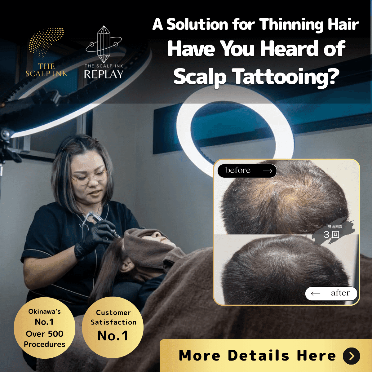 SCALP INK REPLAY Monitor Recruitment LP