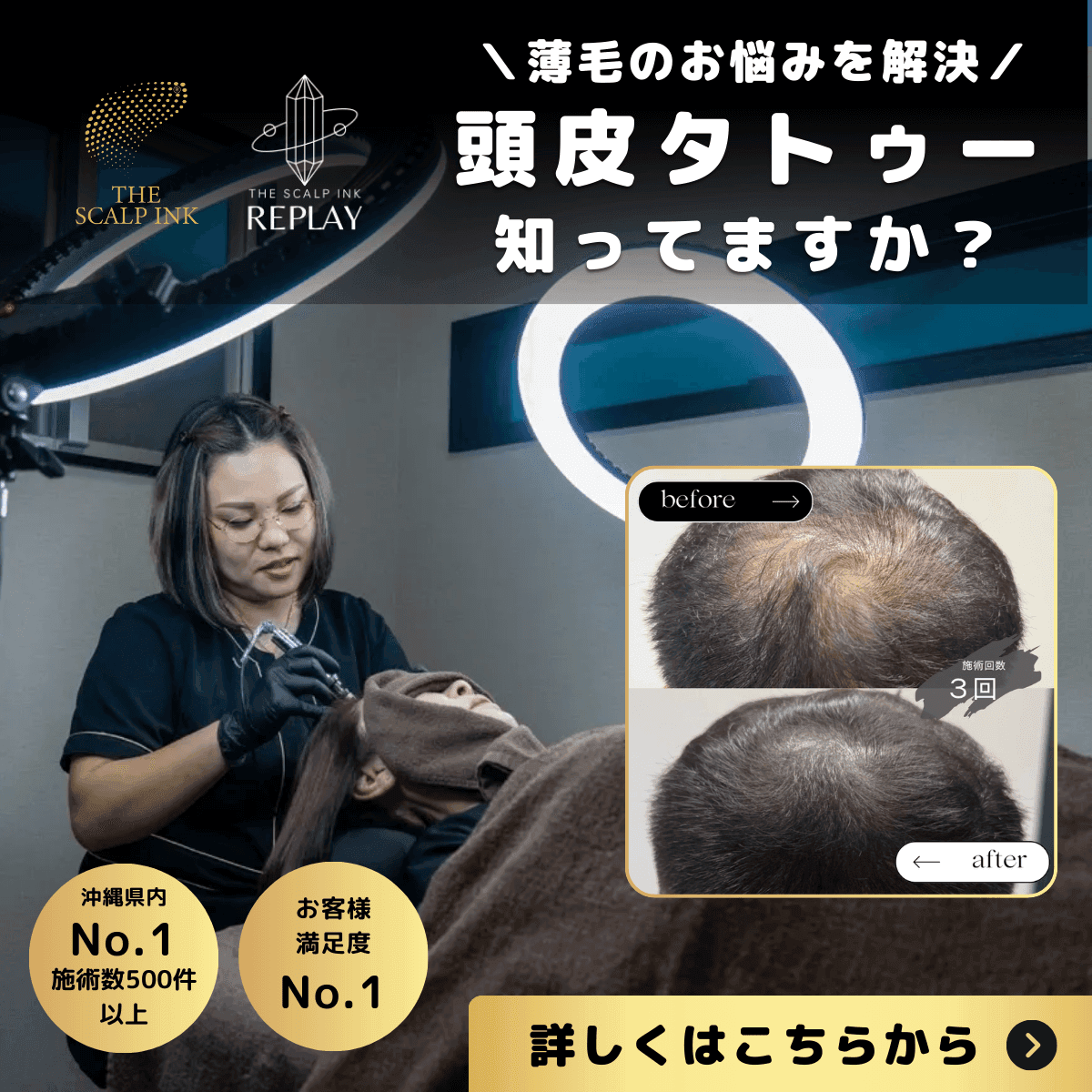 SCALP INK REPLAY モニター募集LP